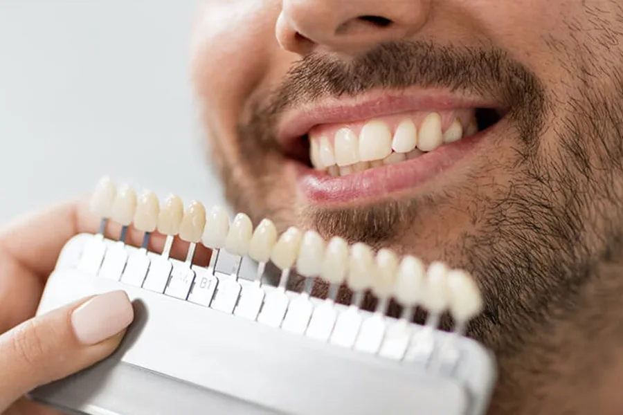 Dental shade selection illustration