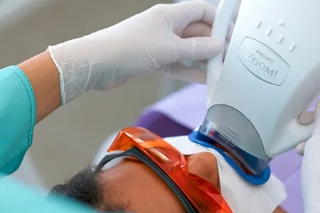 Teeth Whitening treatment at Rahman & Rahman Packages Mall, Lahore