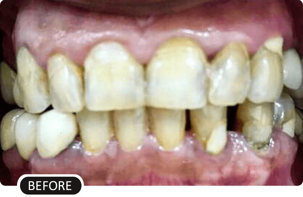before image