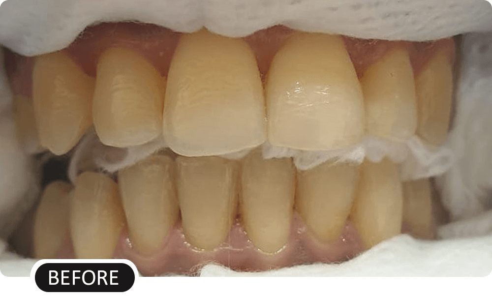 before image