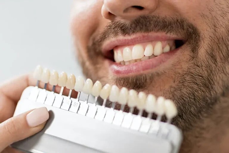 Dentist matching tooth shade with a shade guide next to a smiling patient